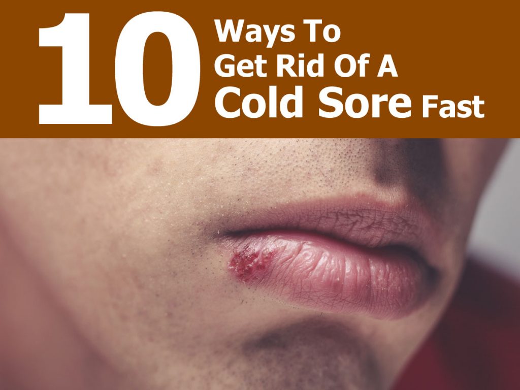 10-ways-to-get-rid-of-a-cold-sore-fast